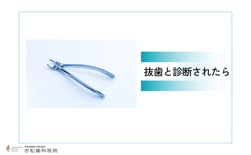 抜歯と診断されたら、セカンドオピニオンで確認する