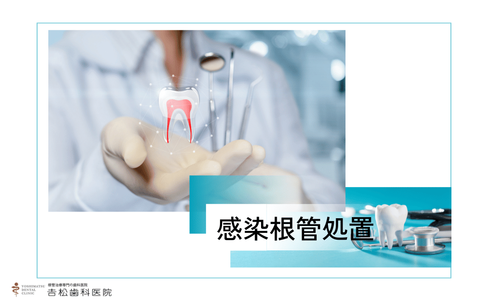放置は危険！感染根管処置の必要性と治療の流れを徹底解説
