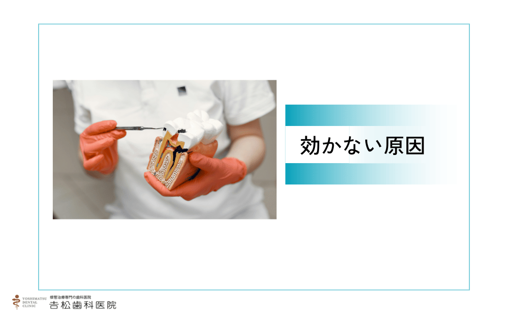なぜ根管治療で痛み止めが効かないのか