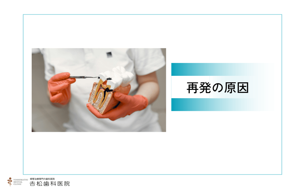 なぜ根管治療は再発するのか