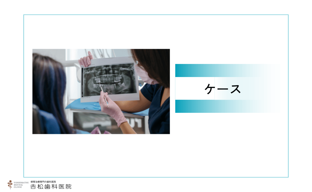 歯の神経を取る必要があるケース