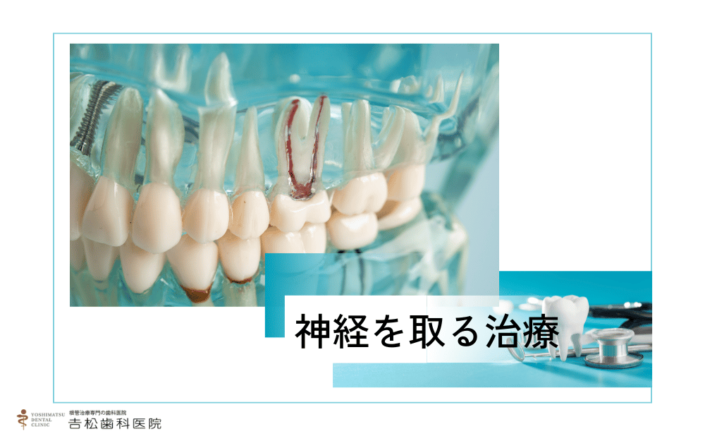 歯の神経を取る治療とは？治療の流れやその後のケアまで徹底解説