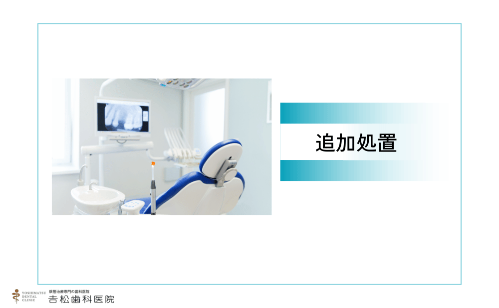 歯科医院で行われる根管治療の痛みの追加処置