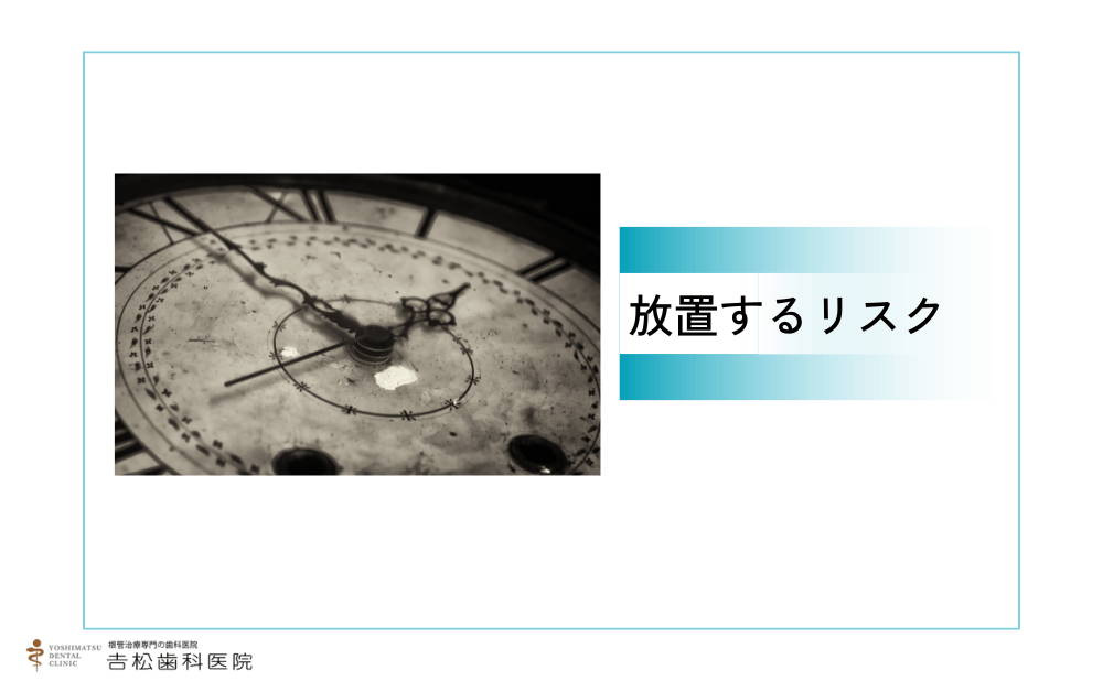 腐った歯を放置するリスク