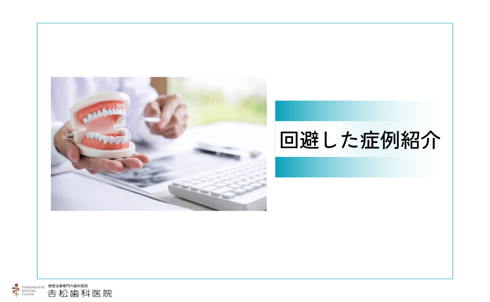 根管治療で抜歯を回避した症例紹介