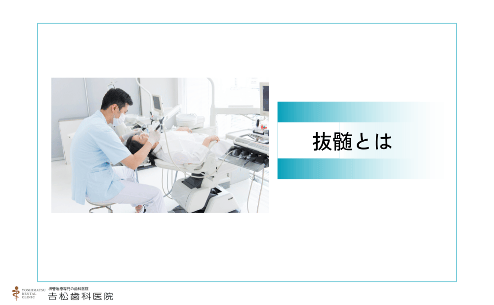 歯の神経を抜く（抜髄）とは