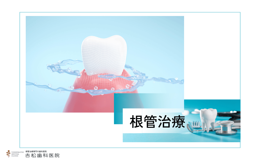 再根管治療で歯を残すために知っておきたい専門医の技術と医院の選び方