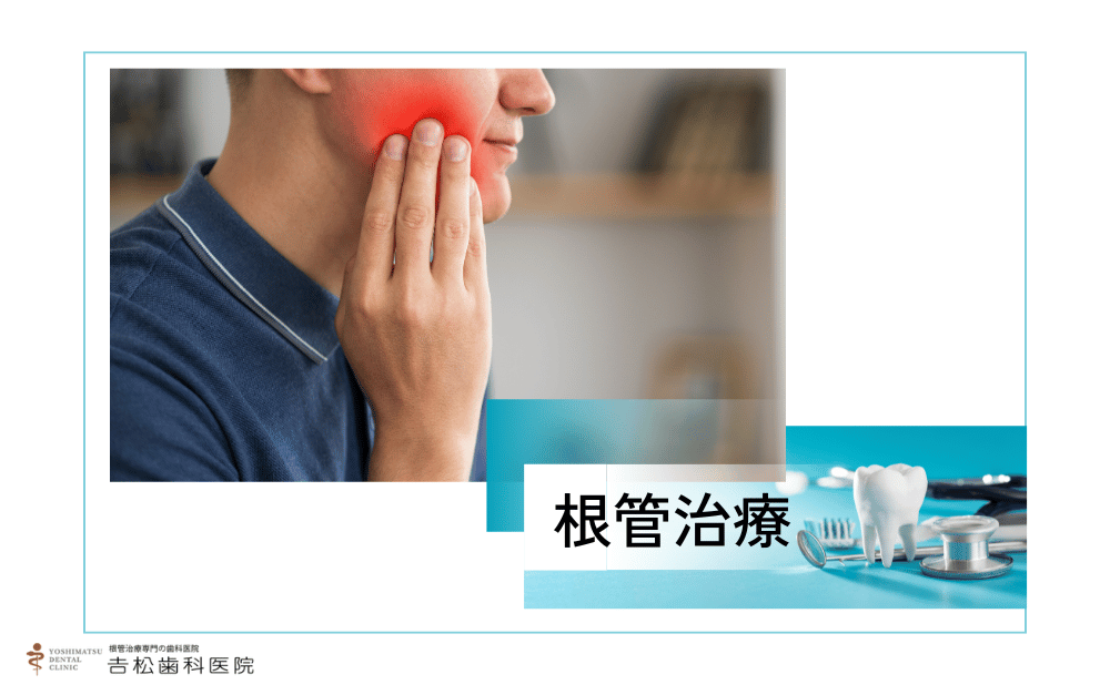 再根管治療は痛い？治療が必要になる理由と痛みの原因をご紹介