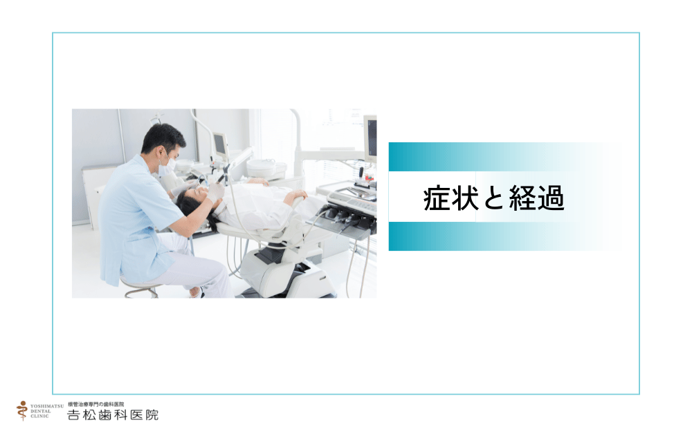 神経ギリギリまで歯を削る治療後に起こりやすい症状と経過