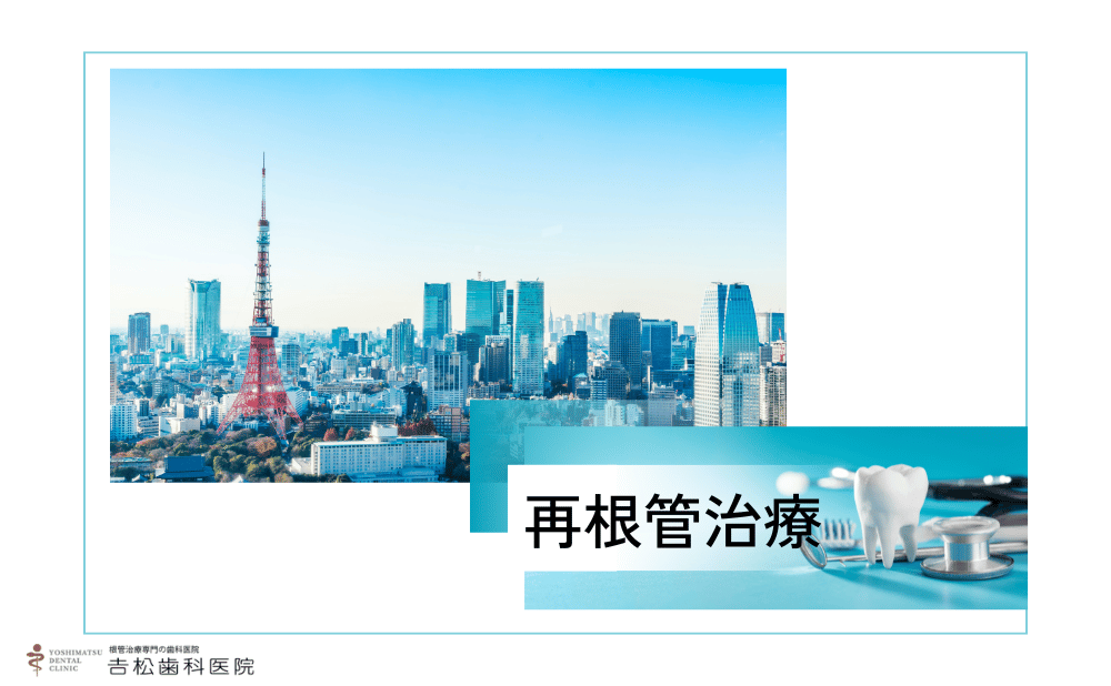 東京で再根管治療するならどこ？名医の選び方と費用相場