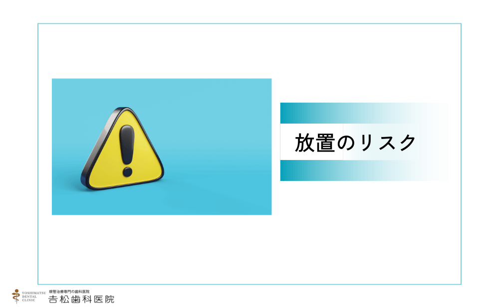 根管治療をしないとどうなる？放置のリスク