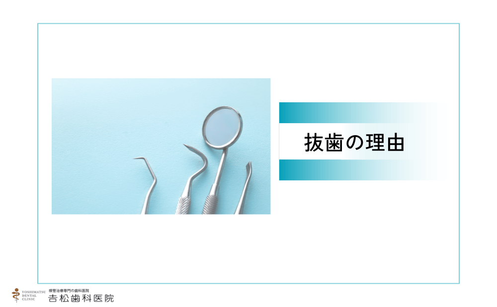 「抜歯しかない」と言われる主な理由