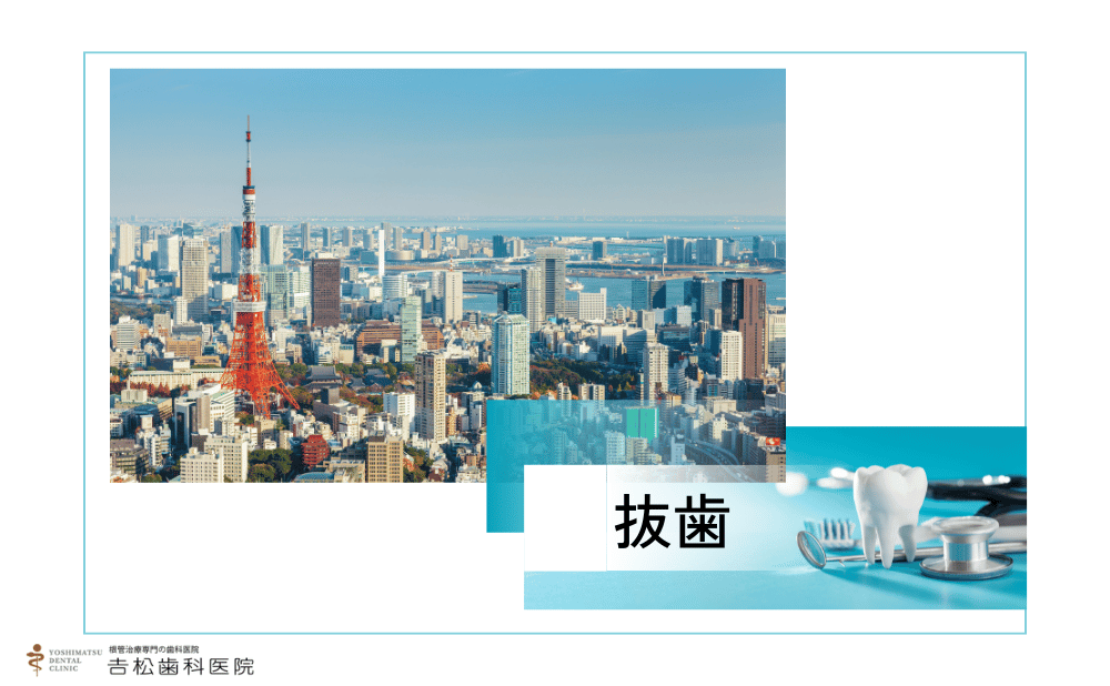 歯を残す治療を東京で検討している方へ！抜歯を避けるための判断軸と歯科医院の選び方